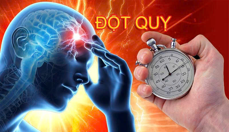 Đột quỵ là gì? Nguyên nhân và 5 sản phẩm hỗ trợ phòng ngừa đột quỵ hiệu quả tại Tram Cathy