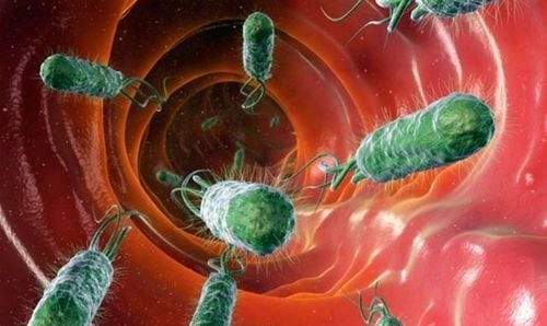 Vi khuẩn HP là gì? Tác hại, triệu chứng và cách điều trị hiệu quả