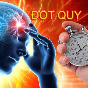 Đột quỵ là gì? Nguyên nhân và 5 sản phẩm hỗ trợ phòng ngừa đột quỵ hiệu quả tại Tram Cathy